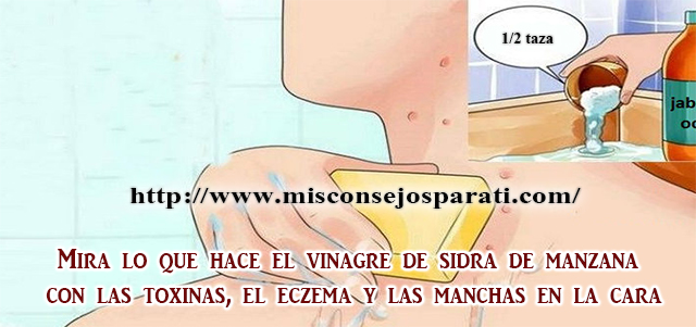 Mira lo que hace el vinagre de sidra de manzana con las toxinas, el eczema y las manchas en la cara