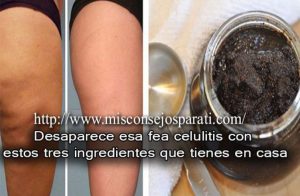 Tratamiento Para la Celulitis en las Piernas