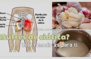 ¿Sufres de ciática? Utiliza este remedio natural para combatirla efectivamente. Es buenísimo