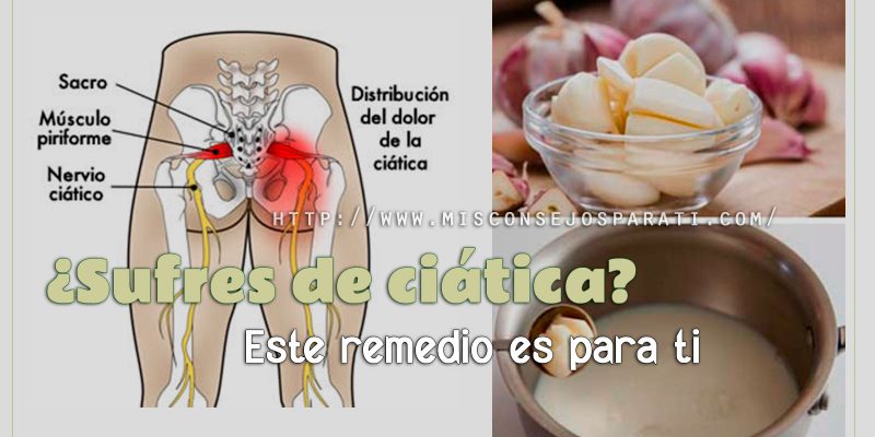 ¿Sufres de ciática? Utiliza este remedio natural para combatirla efectivamente. Es buenísimo