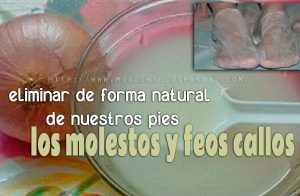 eliminar de forma natural de nuestros piecitos los molestos y feos callos que salen