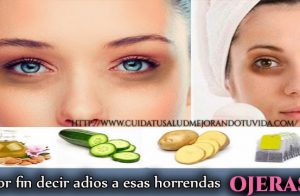 Olvídate de esas molestas ojeras.