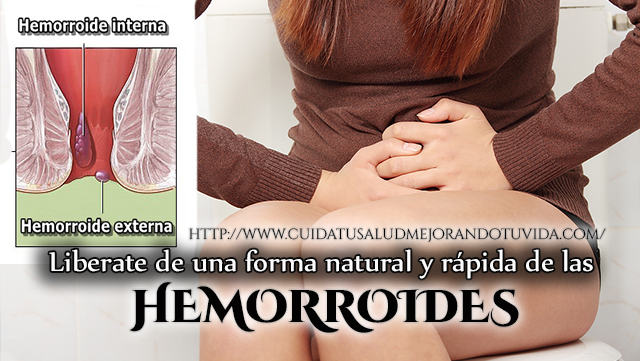 Adiós  hemorroides