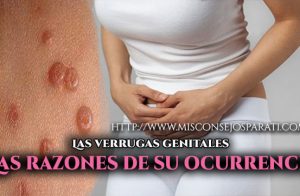 Las verrugas genitales. Las razones de su ocurrencia