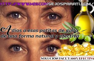 Desaste de esas arrugas al rededor de tus ojos en pocos dias