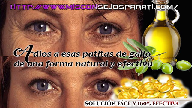 Desaste de esas arrugas al rededor de tus ojos en pocos dias