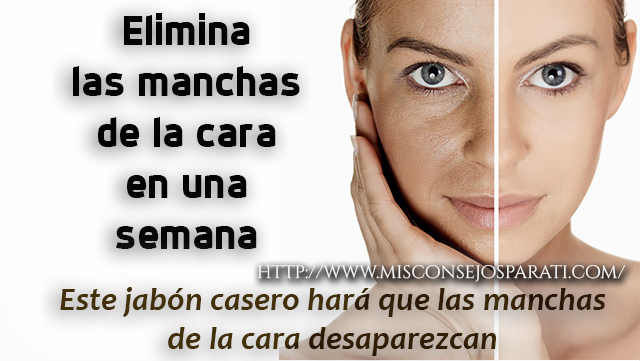 Elimina las manchas de la cara en una semana