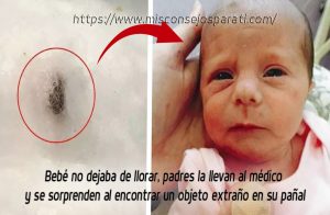 Bebé no dejaba de llorar, padres la llevan al médico y encuentran un objeto extraño en su pañal