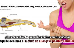 ¿Has descubierto  pequeños bultos en tu muñeca? aquí te decimos el motivo de ellos y su posible solución.