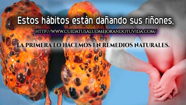 Estos hábitos están dañando sus riñones,