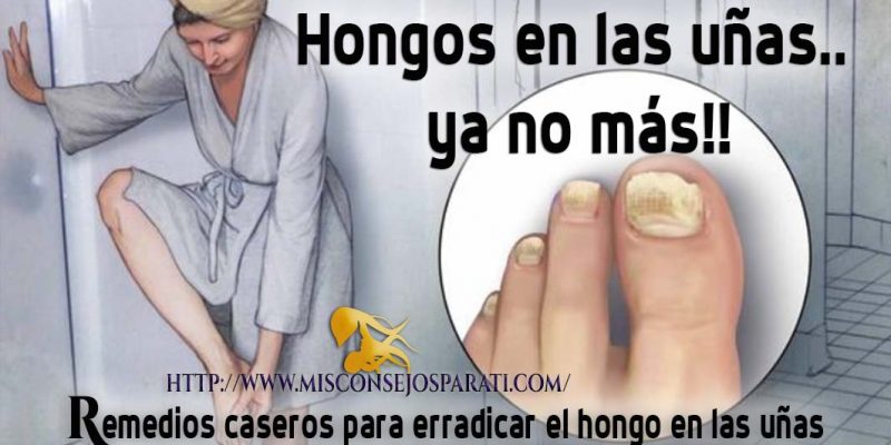 hongos en las uñas.