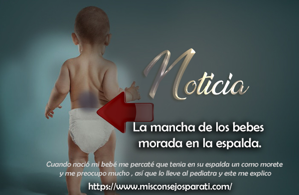 La mancha de los bebes morada en la espalda.