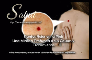 Puntos Rojos en la Piel: Una Mirada Profunda a sus Causas y Tratamiento.