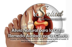 Alivio Natural para la Gota: Remedio Avalado por la Ciencia