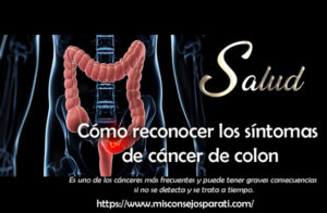 Cómo reconocer los síntomas de cáncer de colon